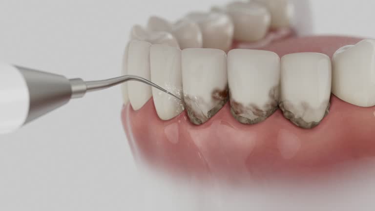 Trusted Invisalign Clear Aligners service in Richmond, MI - Dentist Open Now